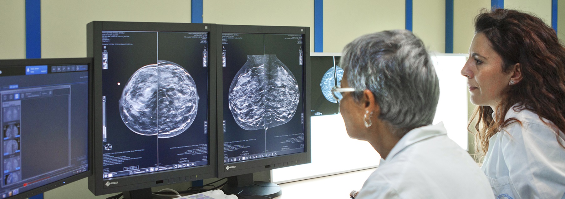 Breast Tomography System